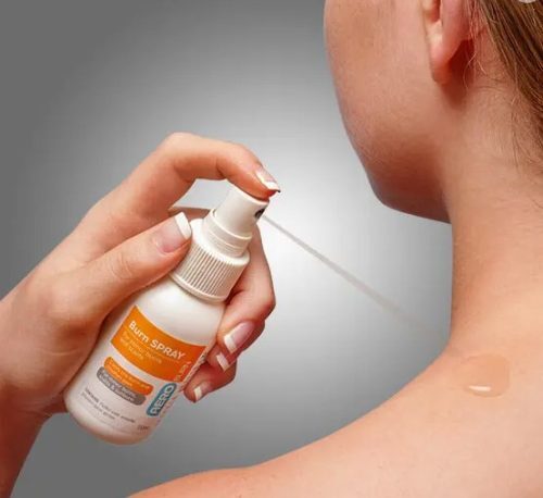 Burn Spray